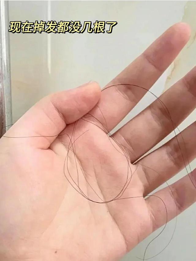 头发不好怎么养发（原来养发是这么简单）(6)