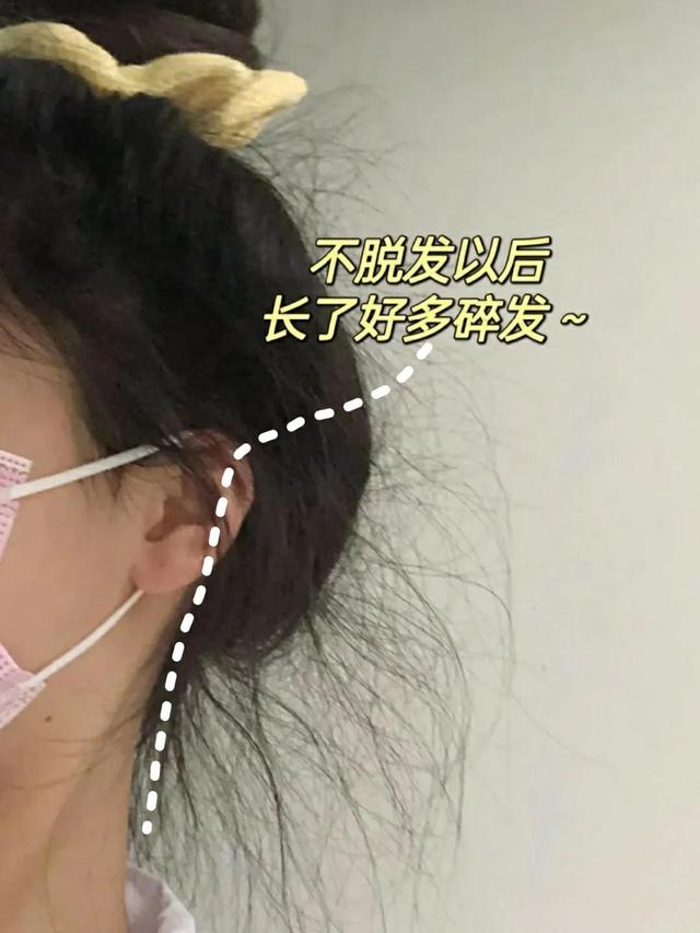 头发不好怎么养发（原来养发是这么简单）(2)