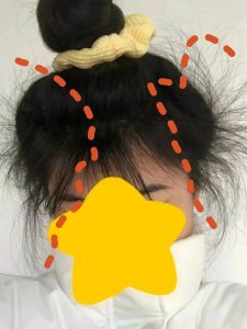 ​头发不好怎么养发（原来养发是这么简单）